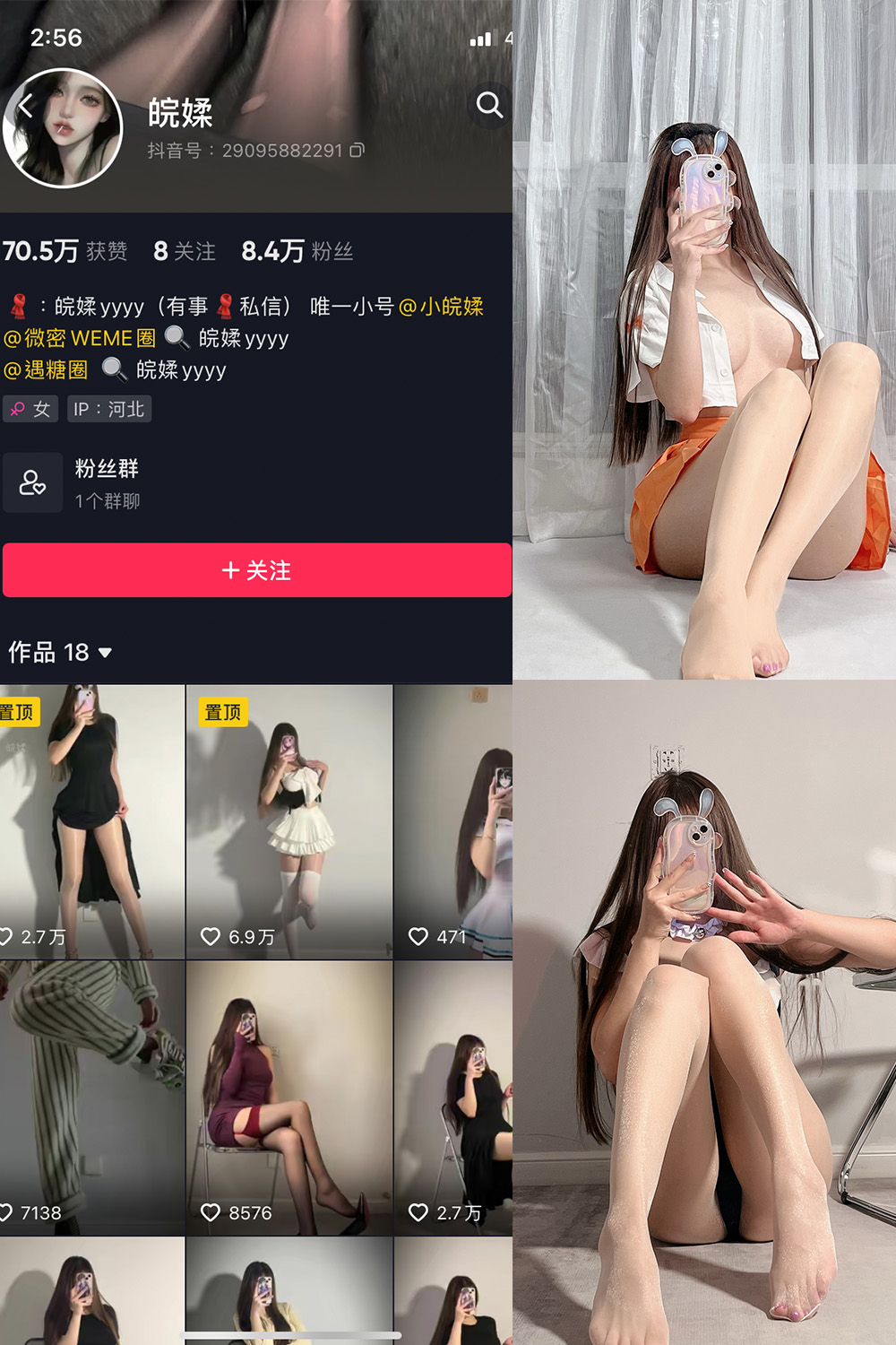 抖音 皖媃yyyy VIP 微密圈  NO.002期 【20V】-艺库