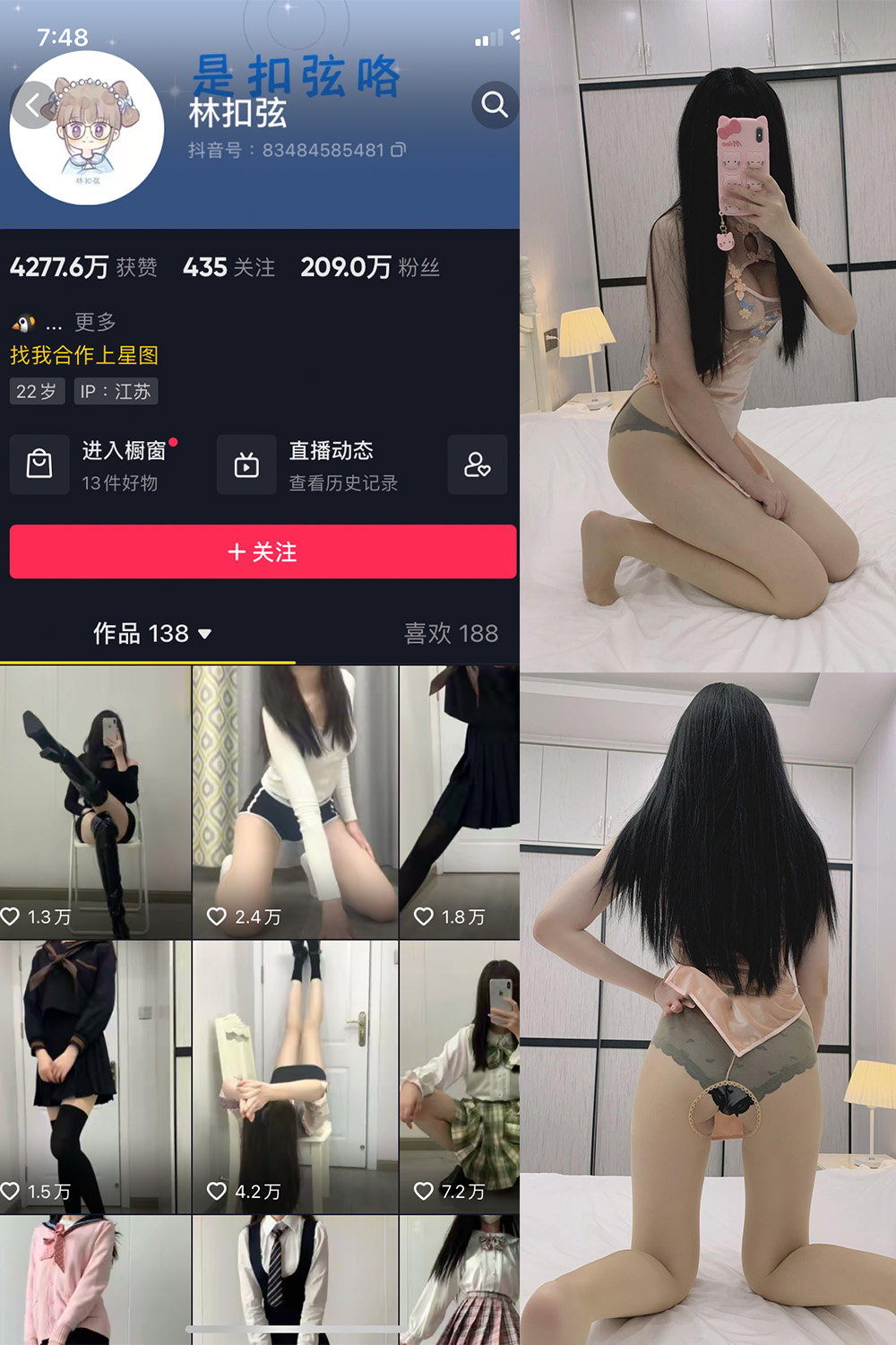 抖音 林扣弦 微密圈  NO.038期 【31P】-艺库