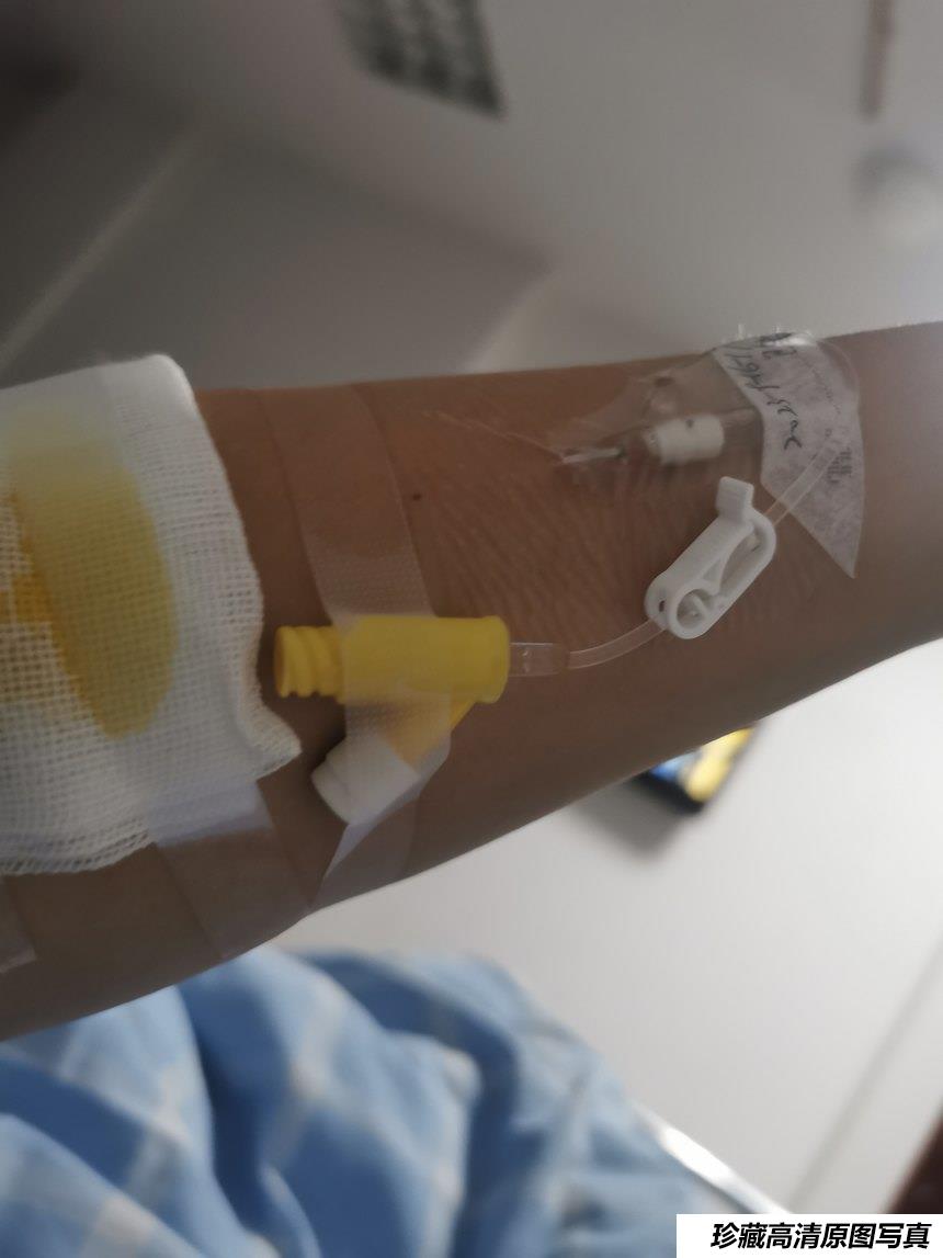 [XiuRen秀人网] 2023.10.25 No.7561 杏子Yada [80+1P]